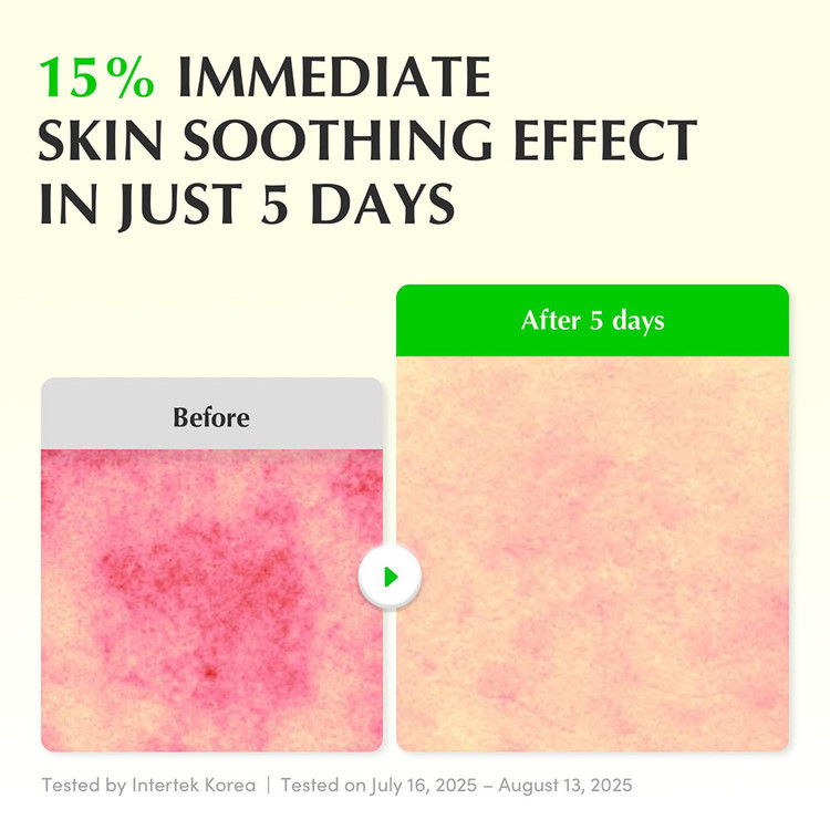 سرم PDRN و آلوئه ورا اکوال بری ترمیم کننده و تسکین دهنده قوی پوست EQQUALBERRY Aloe PDRN Calming Serum برند: اکوال برری EQQUALBERRY